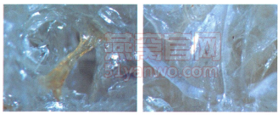 显微镜下的正品燕窝表面
